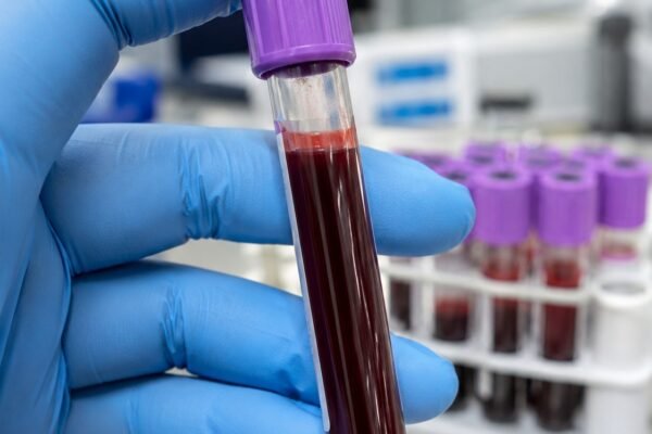 englandhepatitiscelimination image1